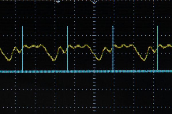 Arduino Frequency Detection