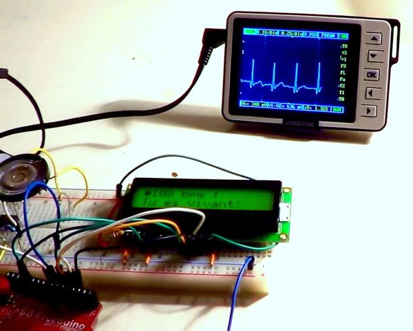 Electrocardiograph Heart Rate Monitor