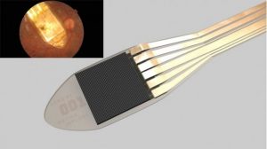 A new form of retina implant returns sight to the blind