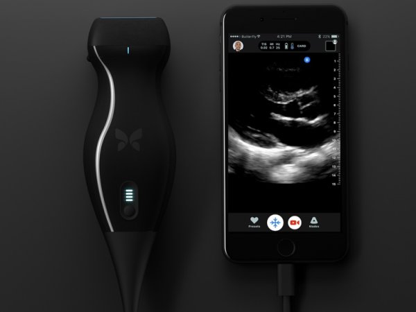 Butterfly IQ – Ultrasound Anywhere Anytime