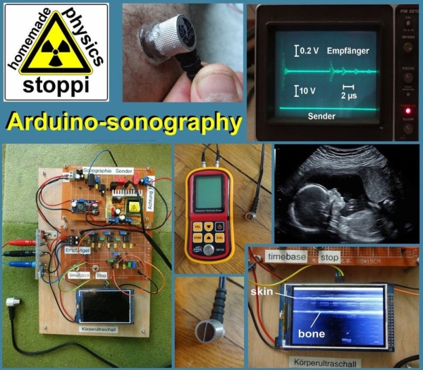 Body ultrasound Sonography With Arduino